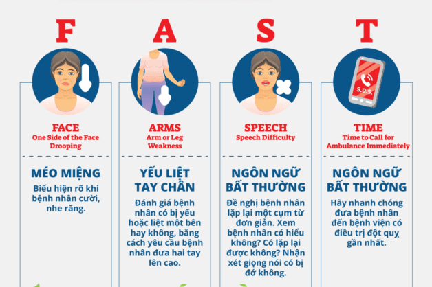 Các bước nhận biết bệnh nhân đột quỵ