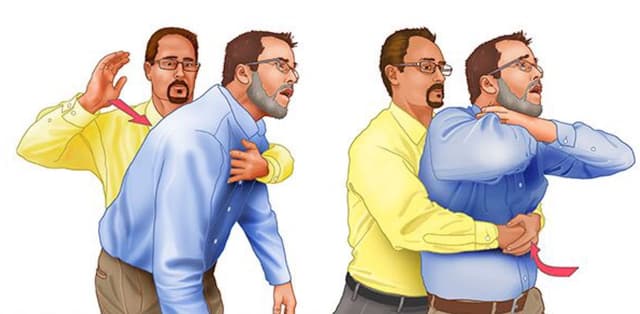 Học phương pháp sơ cứu hóc dị vật Heimlich
