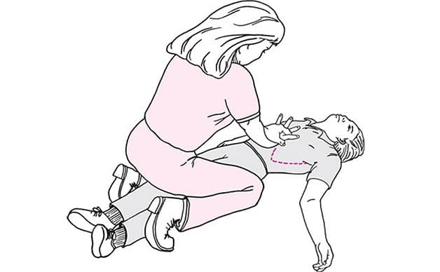 Phương pháp sơ cứu hóc dị vật Heimlich cho bệnh nhân bất tỉnh