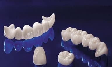 Quy trình phục hình răng sứ trong trồng răng Implant