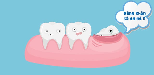 Răng cùng có nên nhổ – Tìm câu trả lời ngay