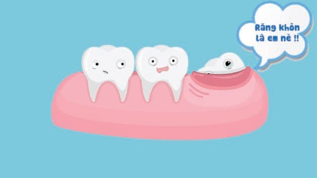 răng cùng có nên nhổ hay để lại