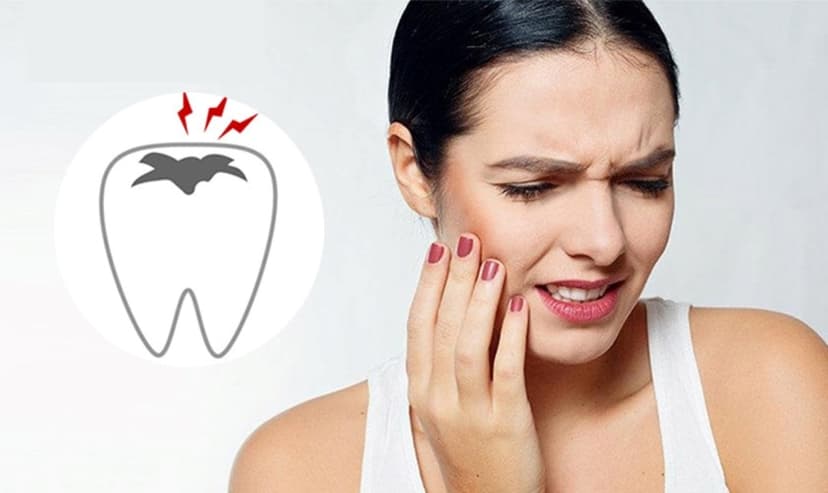 Phương pháp chữa răng sâu lồi thịt dứt điểm