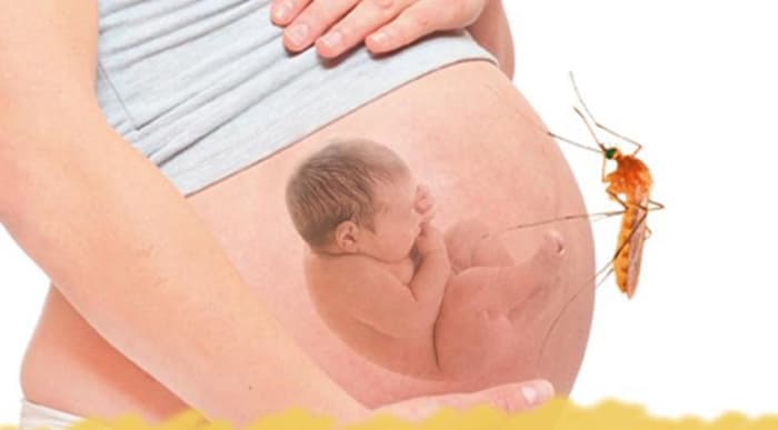 Ngoài việc không hiểu đúng về việc tắm khi mắc sốt xuất huyết, mẹ bầu thường mắc phải những sai lầm khác khiến bệnh trở nên nghiêm trọng hơn