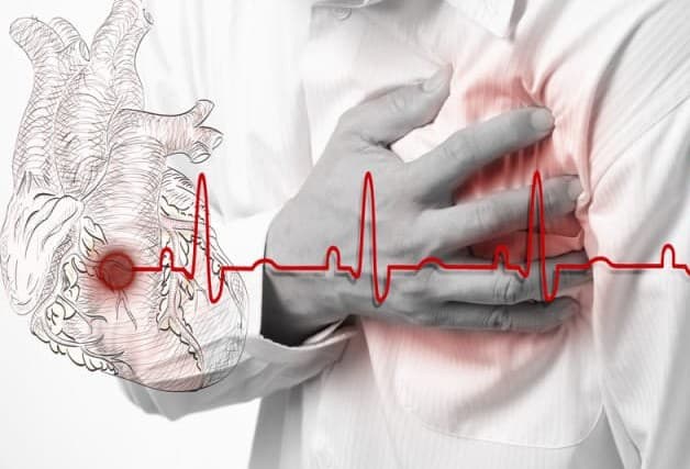 bệnh tim do thiếu máu cục bộ