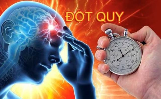 Tìm hiểu về thời gian điều trị đột quỵ hiệu quả cao