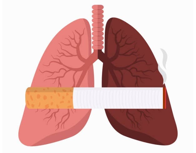 Thuốc là là nguyên nhân hàng đầu gây bệnh COPD