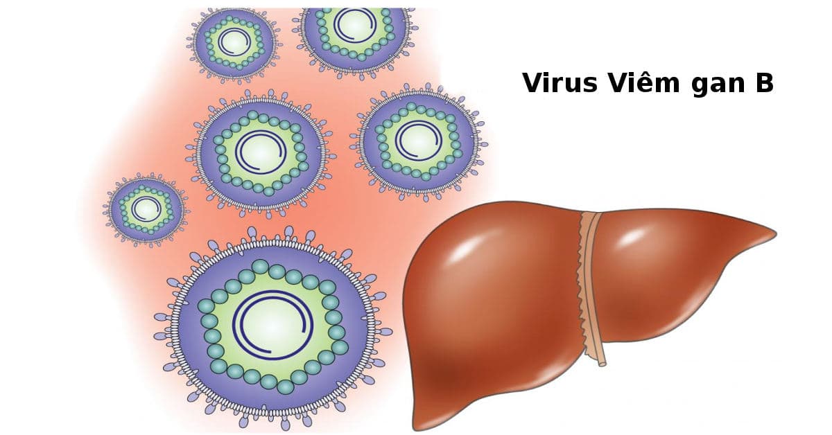 Viêm gan B là căn bệnh nhiễm trùng gan do virus viêm gan B (HBV) gây ra
