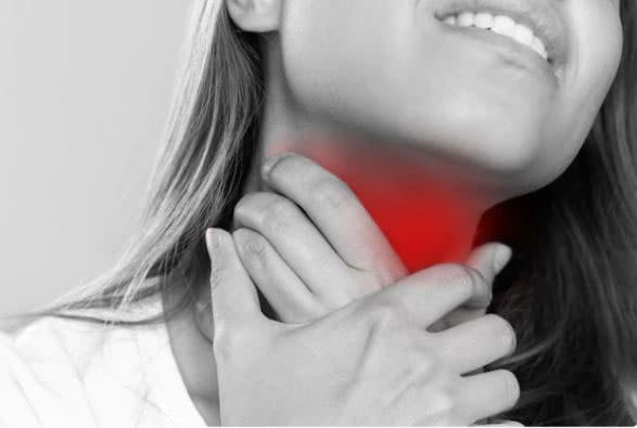 Triệu chứng trào ngược dạ dày gây viêm amidan