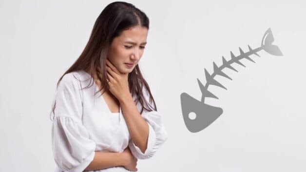 triệu chứng hóc xương cá