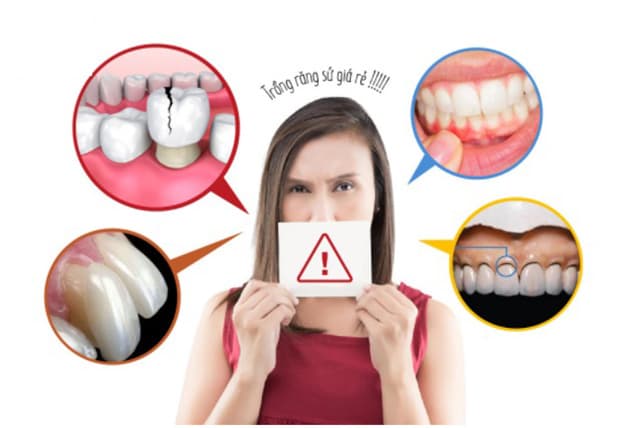 trồng răng sứ giá rẻ được không