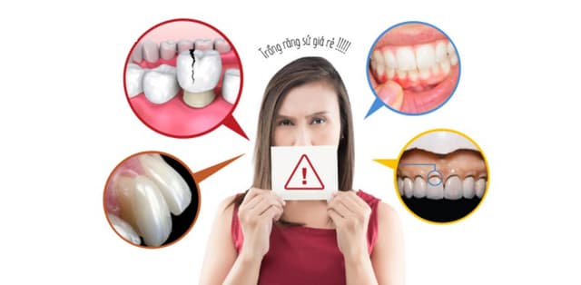 Cẩn trọng trước lời mời trồng răng sứ giá rẻ