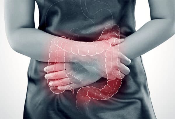 Viêm đại tràng thiếu máu cục bộ