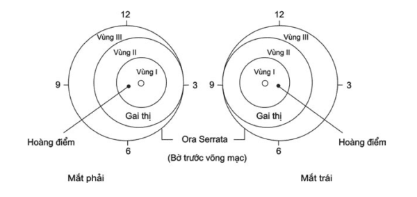 võng mạc non vùng 1