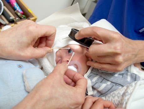 Cách điều trị bệnh võng mạc ở các bé sinh non-2