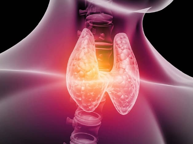 Tuyến giáp có nang là bệnh lý lành tính