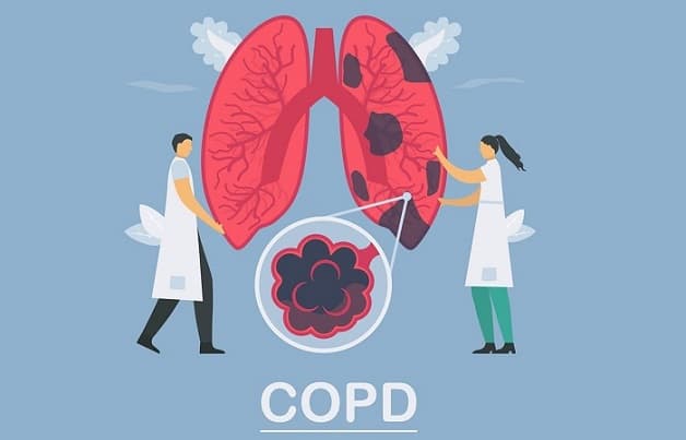 Bệnh COPD có điều trị khỏi được không?