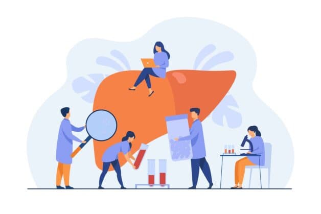 Bệnh gan nhiễm mỡ do lượng mỡ tích tụ trong gan quá nhiều