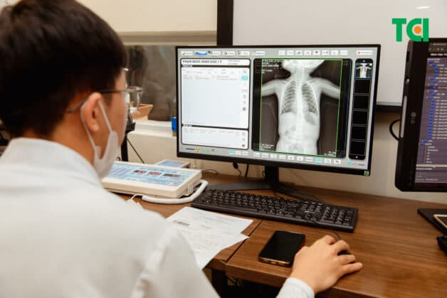 Viêm phổi là một trong những biến chứng nghiêm trọng của bệnh sởi ở trẻ nhỏ.