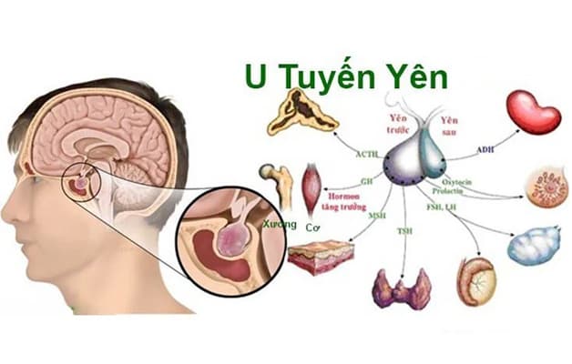 Cấu tạo tuyến yên