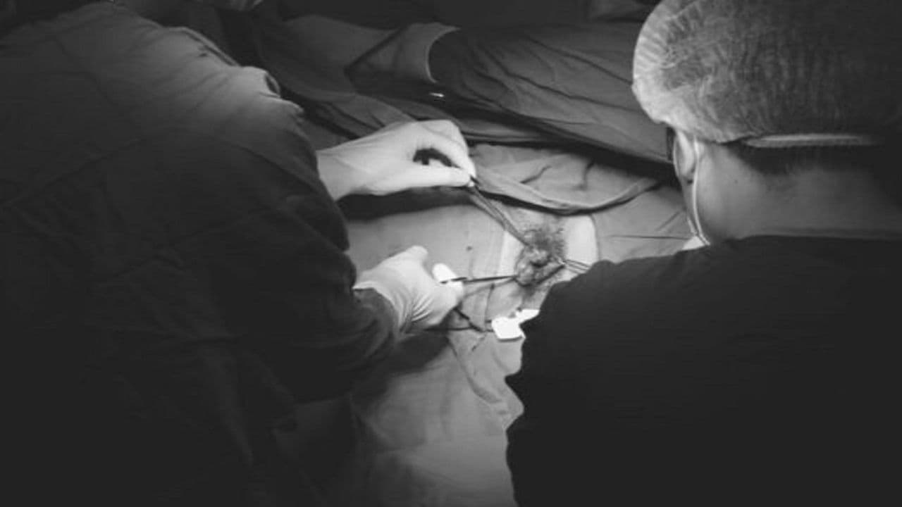 Bệnh trĩ ngoại và cách chữa