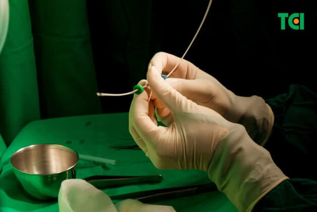 Điều trị trĩ bằng Laser Diode