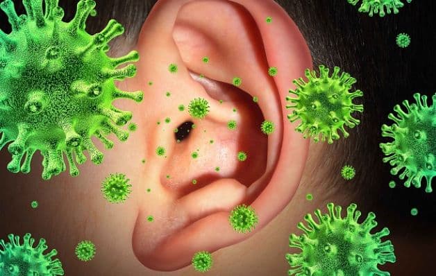 Virus và vi khuẩn là nguyên nhân phổ biến nhất gây viêm tai giữa ở trẻ