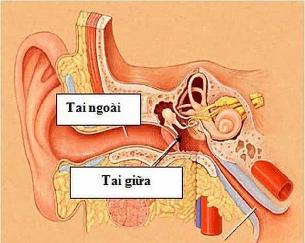 Dấu hiệu bệnh viêm tai ngoài và viêm tai giữa ở trẻ có nhiều điểm khác nhau