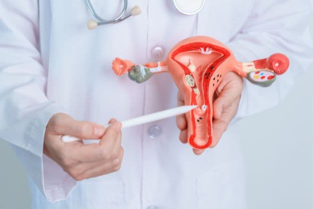 bị u xơ tử cung thường gặp ở chị em phụ nữ ở độ tuổi sinh sản