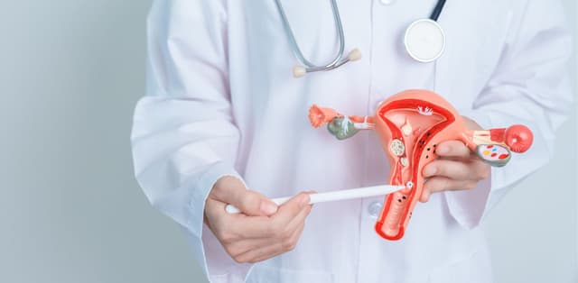 Những lưu ý quan trọng khi chị em bị u xơ tử cung