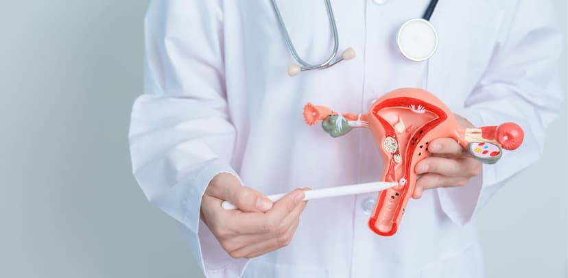 Những lưu ý quan trọng khi chị em bị u xơ tử cung