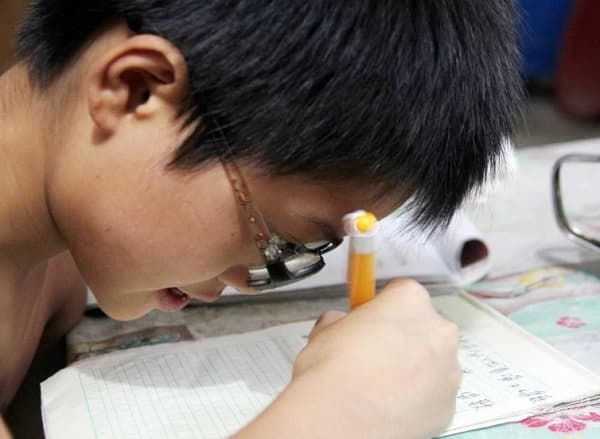 Tìm hiểu về các mức độ của tật cận thị