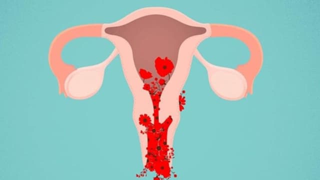 Rong kinh là gì và dấu hiệu rong kinh chị em không nên bỏ qua