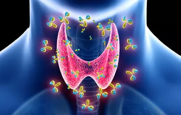 Nguyên nhân gây viêm tuyến giáp chủ yếu từ việc tế bào miễn dịch tự tấn công tế bào tuyến giáp.