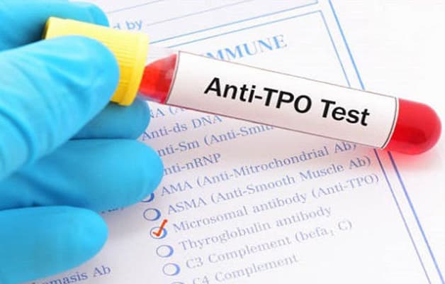 Xét nghiệm chẩn đoán viêm tuyến giáp.