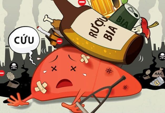 Thoái hóa mỡ ở gan do rượu là nhóm nguyên nhân phổ biến và cũng nguy hiểm nhất