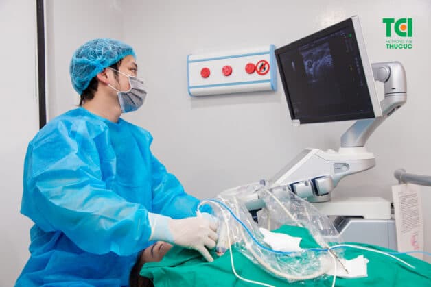 Kỹ thuật sinh thiết u vú dưới hướng dẫn siêu âm và lực hút chân không (VABB) được triển khai tại Thu Cúc TCI.