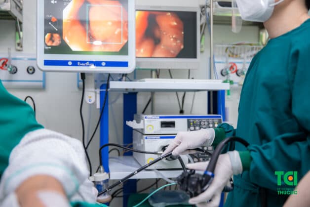 Phát hiện ung thư thực quản giai đoạn sớm gia tăng cơ hội điều trị