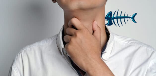 khi nào cần Nội soi gắp xương cá