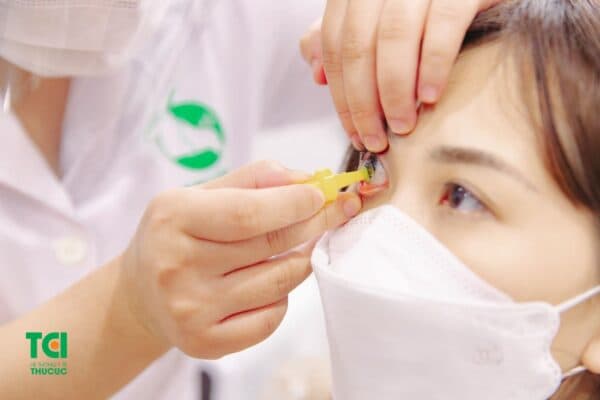 Giải đáp việc đeo kính Ortho k có hết cận không?