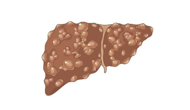 Quy trình thực hiện thủ thuật sinh thiết gan