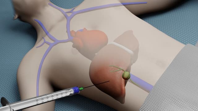 Hiểu về quy trình sinh thiết gan