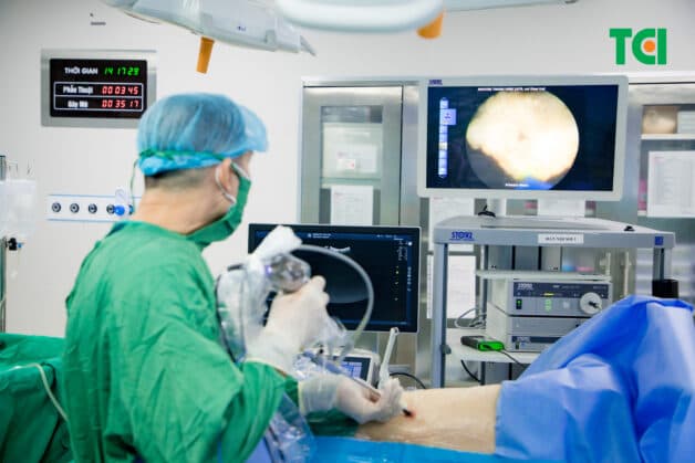 Tán sỏi qua da đường hầm nhỏ - Phương pháp chữa sỏi thận hạn chế xâm lấn