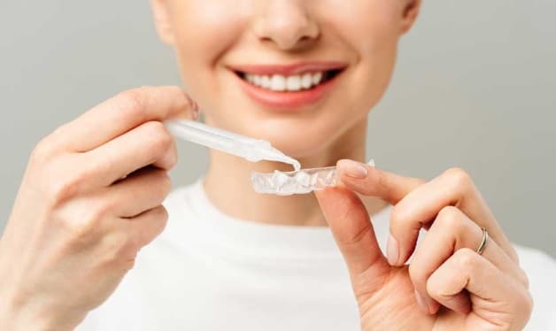 Tẩy trắng răng ở Hà Nội