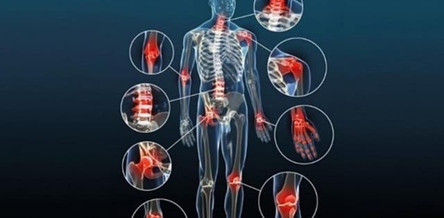 Thoái hóa khớp: Các vị trí thường gặp và biểu hiện