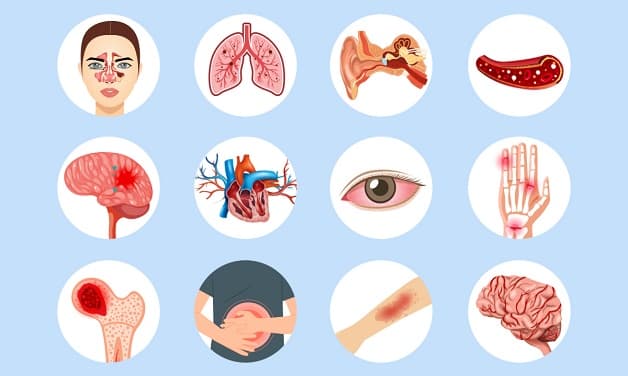 tiêm chủng mở rộng có mũi phế cầu không