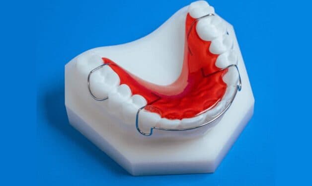 Những thay đổi trước và sau niềng răng