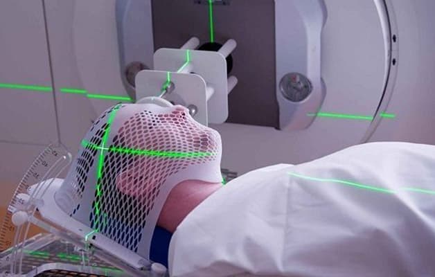 Tiếp xúc với bức xạ ion hóa có thể dẫn đến hình thành ung thư tuyến giáp sau từ 10-20 năm kể từ ngày phơi nhiễm.