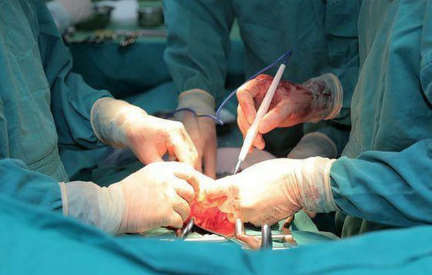 Phẫu thuật tuyến giáp tại TCI được thực hiện bởi đội ngũ y bác sĩ đầu ngành.