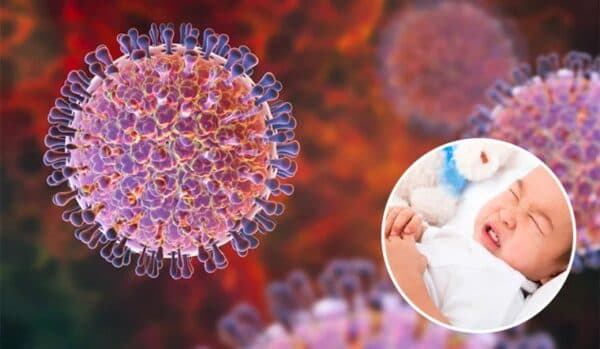 Bệnh do virus rota gây ra có đặc trưng là trẻ đi ngoài nhiều dẫn đến mất nước.